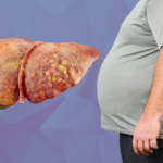 Doctors discussing liver health and preventive healthcare in India